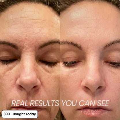 Blooma™ Anti Aging Collagen Stick